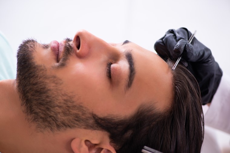 How much is a 5000 graft hair transplant - Dr Malay Mehta