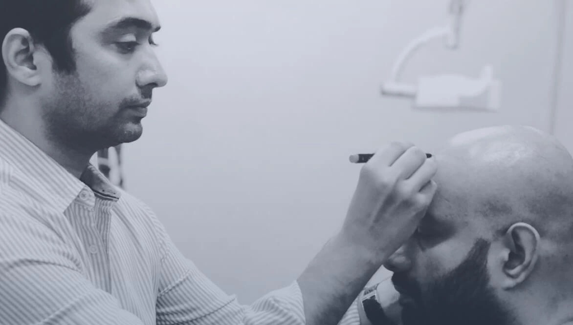 Types of Hair Transplant | Hair Transplant Techniques | Process of Hair Transplant