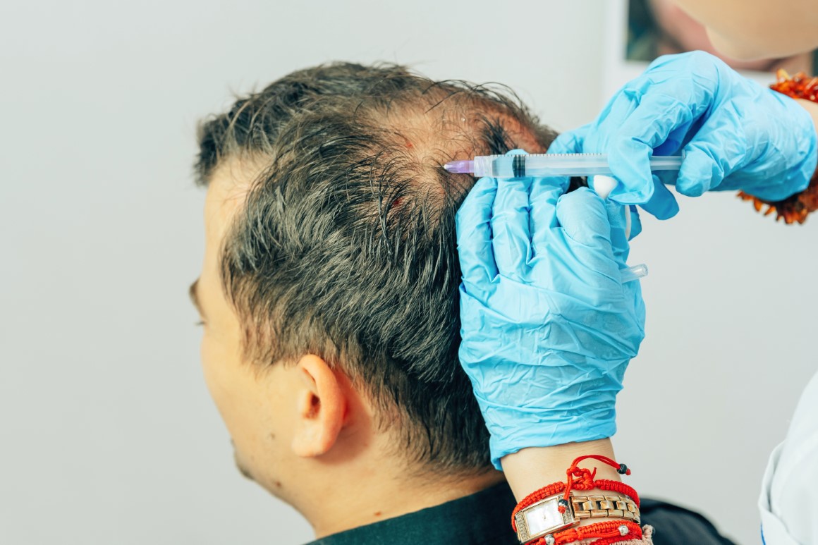 gfc treatment for hair