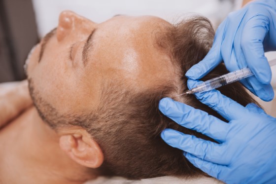 growth factor concentrate therapy for hair
