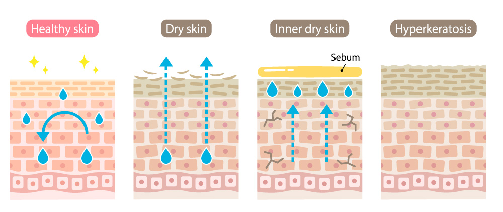 dull skin treatment, dead skin cells, skin glow, healthy skin