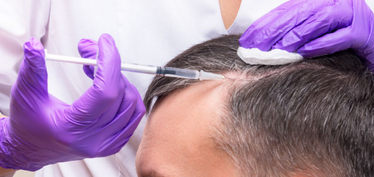 PRP Therapy for Hair and Face