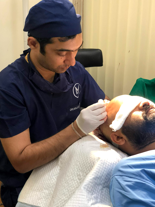 scalp micropigmentation mumbai