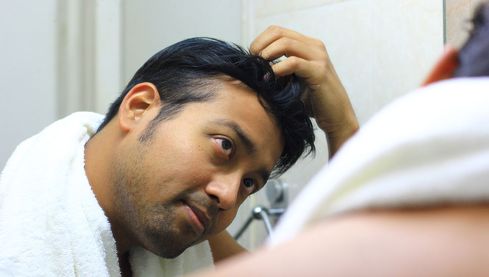 Hair Transplant Success Rate: Key Factors That Affect Your Results
