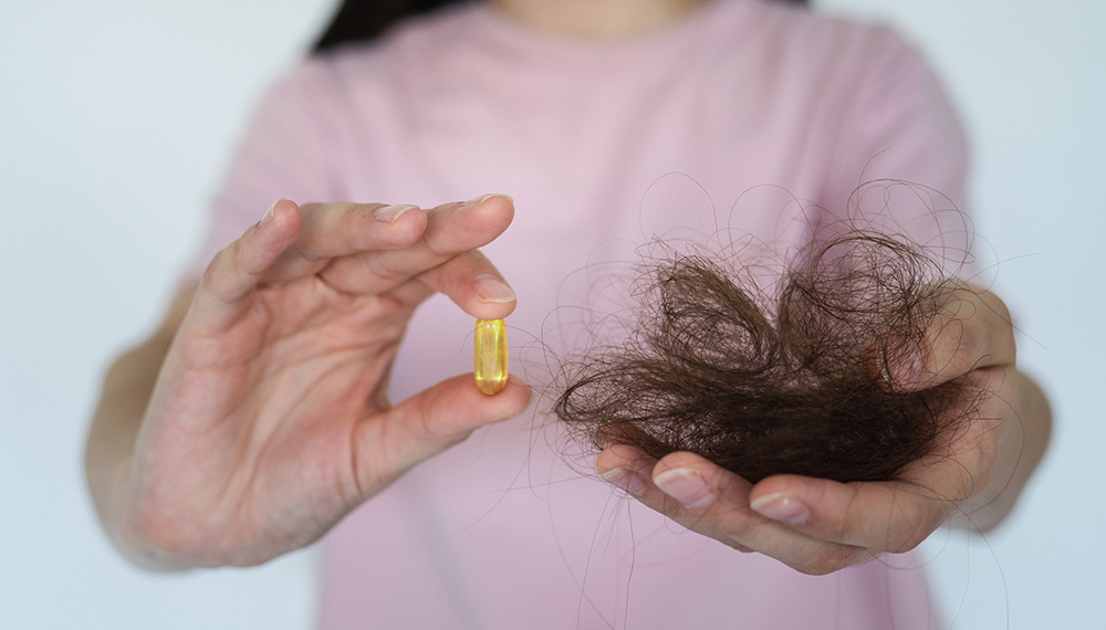 Which Vitamin Deficiency Causes Hair Loss?