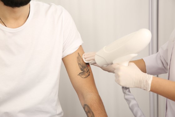 Laser tattoo removal Mumbai - Dr Malay Mehta
