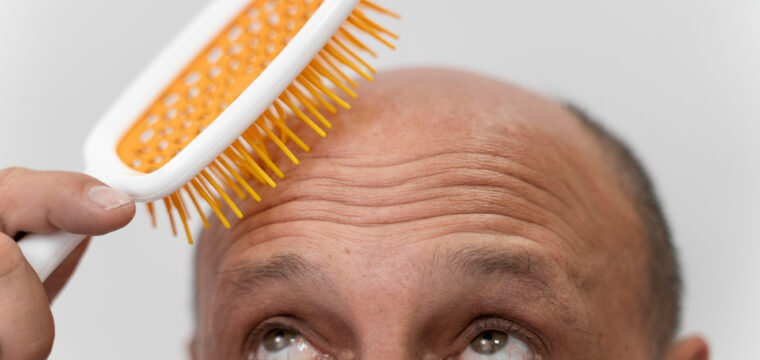 Tracking Hair Transplant Growth Over Time
