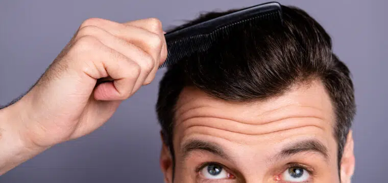 side effects of hair transplant in india