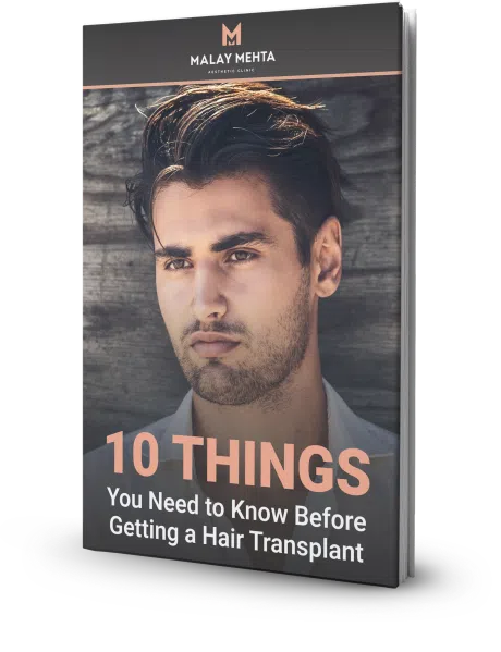 10 Things You Need to Know Before Getting a Hair Transplant