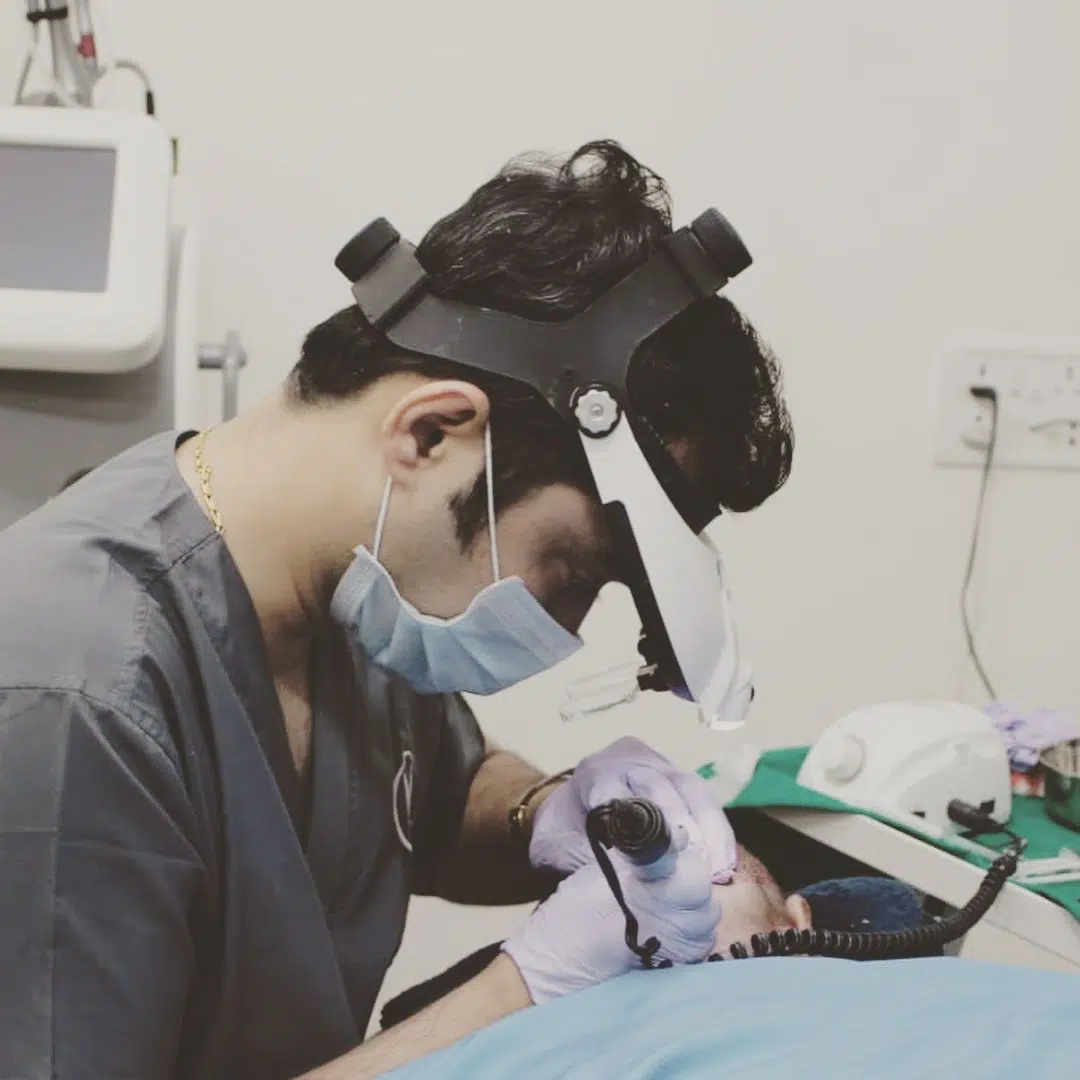 Gym After Hair Transplant | Exercise After Hair Transplant | Workout After Hair Transplant