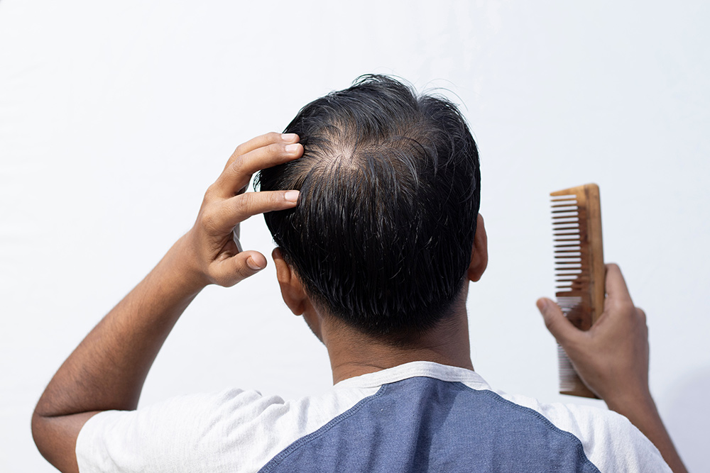 itchy scalp and hair loss, hair transplant procedures, hair loss treatments, hair restoration