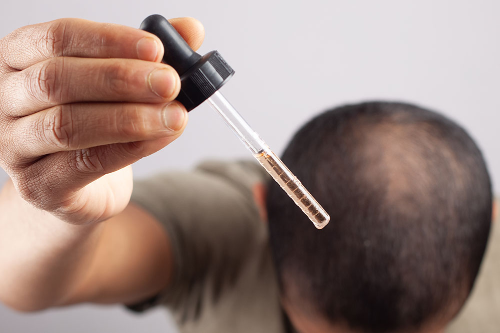 Minoxidil for Hair Growth | Minoxidil for Hair Loss | How to Use Minoxidil for Hair Growth
