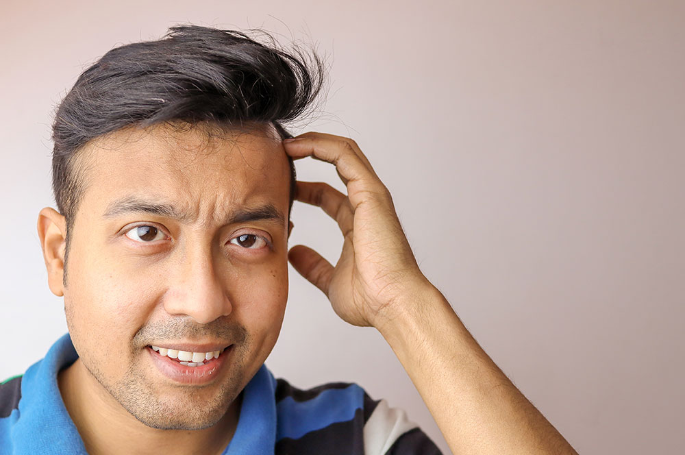 Hair Transplant Success Rate | Does Hair Transplant Work | Is Hair Transplant Successful | How Effective is Hair Transplant
