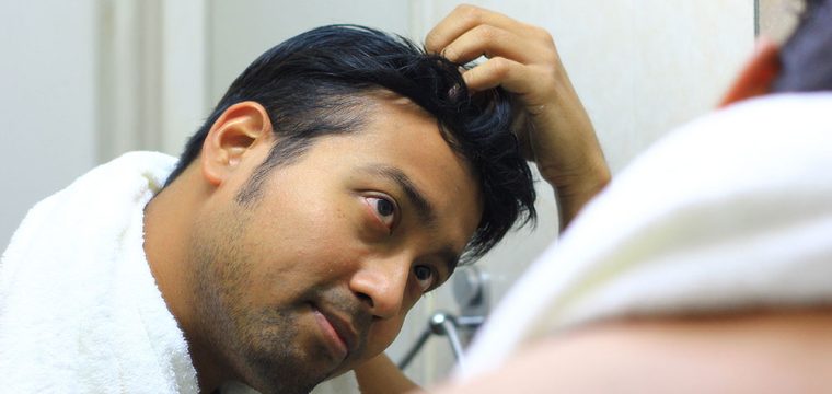 Hair Transplant Success Rate | Does Hair Transplant Work | Is Hair Transplant Successful | Is Hair Transplant Worth It